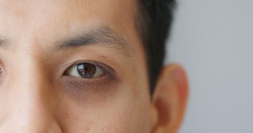 遮黑眼圈指南：介紹4種常見的遮瑕品類型+彩妝師推薦瑕技巧！