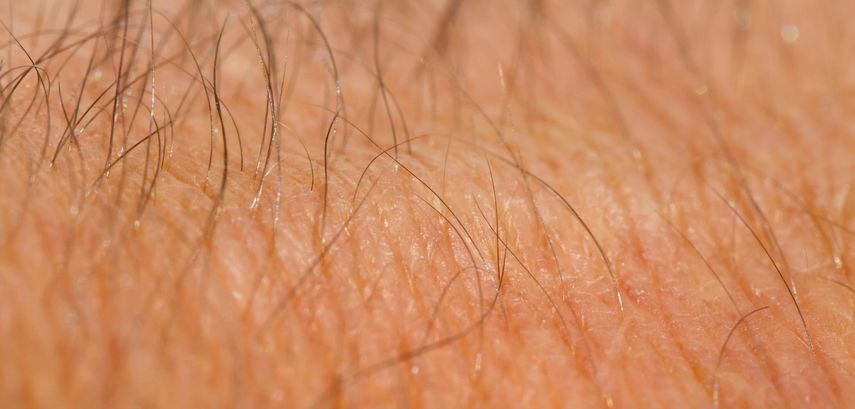 汗毛去除教學：解析6大汗毛多的原因+簡單上手的除毛方法！