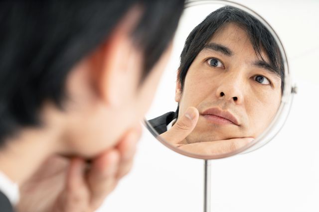 【去虎紋】如何消除法令紋？小紅書都在用疤痕貼？5大方法實測2週去虎紋！