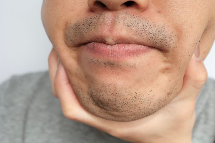 鬚根黑點消除：分析4大徹底剃除鬍子的重要性+正確步驟拆解！