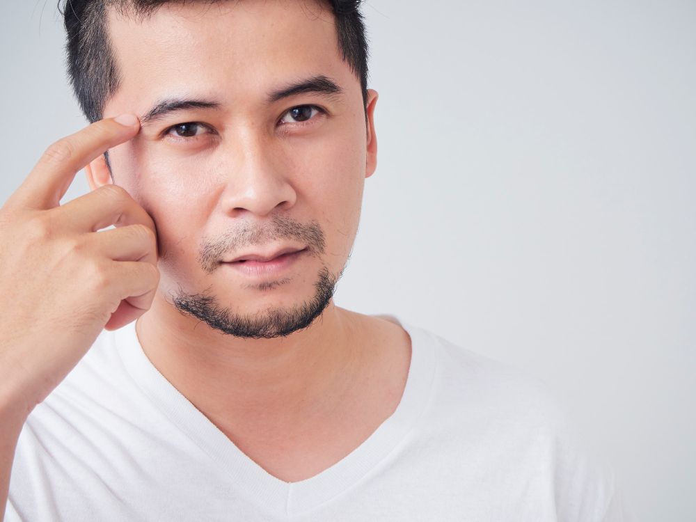 眼袋浮腫破解方案：拆解3大眼袋的形成原因+眼袋手術風險！