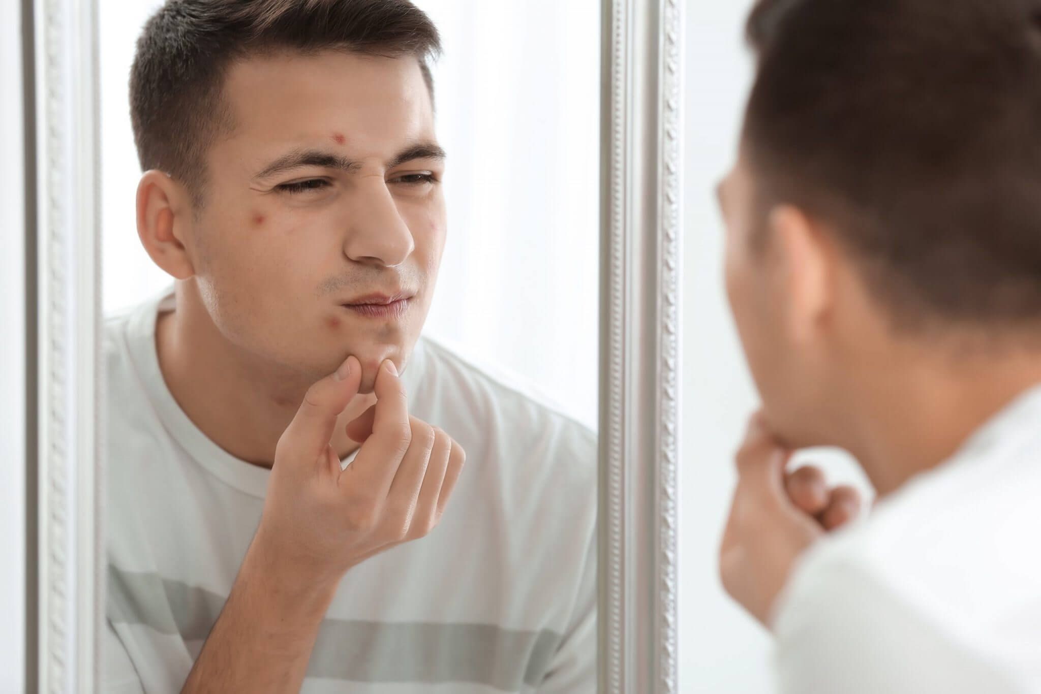 男士去的暗瘡謬誤！狂飲涼茶真有用嗎？