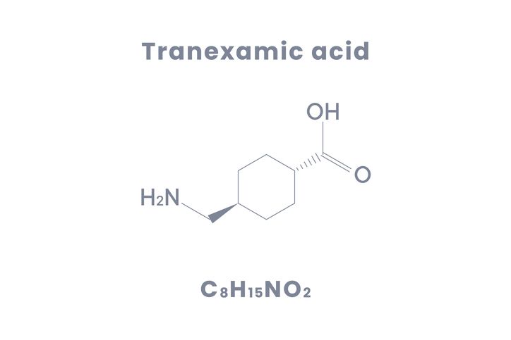 傳明酸功效解析：4大美容優勢+使用攻略、需注意事項與迷思破解