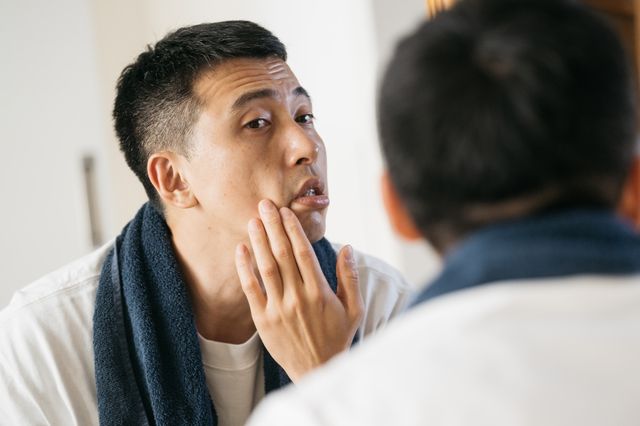 虎紋填充：4種填充物料逐個數，少女針定肉毒桿菌好？不想打針要做xx去法令紋！