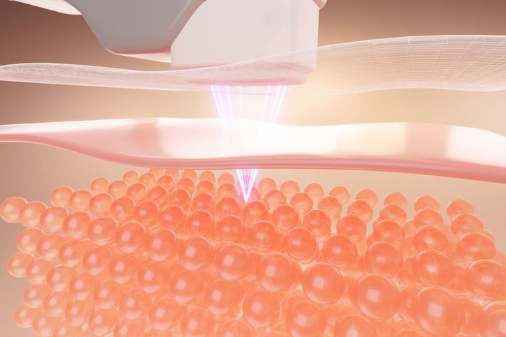 鋼筋索副作用解析：可解決5種常見皮膚問題+潛在風險須知！