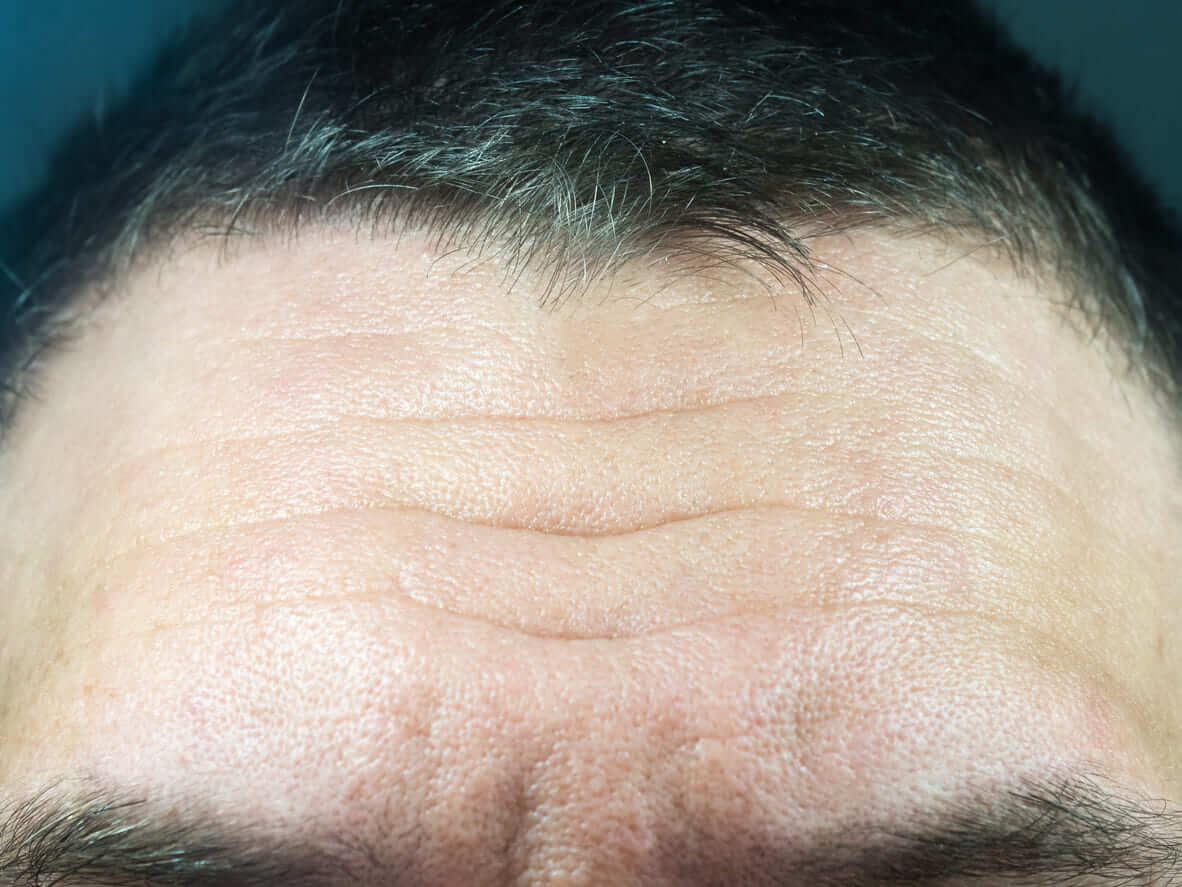 【抬頭紋】額頭皺紋、火車軌讓你極度顯老？進來學5個動作撫平抬頭紋！嫌麻煩的話用這招取代就可以了！