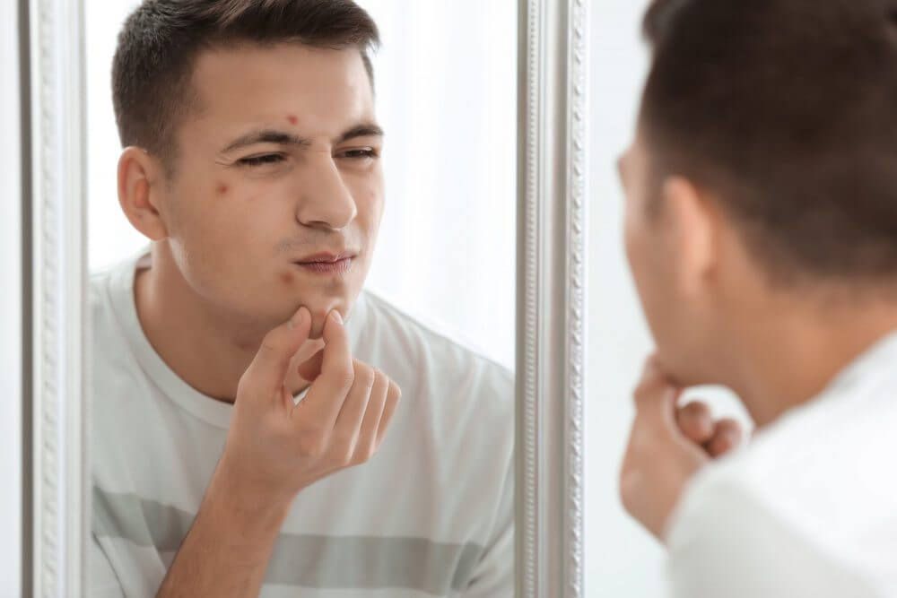 壓力瘡位置有甚麼原因?壓力瘡還會在身體出現