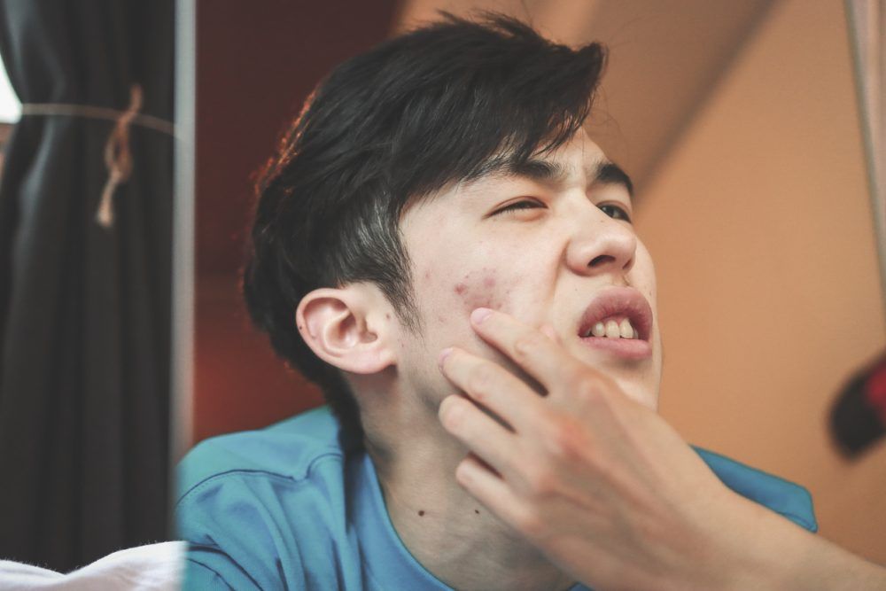 什麼是口罩肌？為什麼戴口罩會皮膚差？