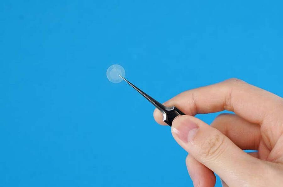 暗瘡貼可以用在甚麼暗瘡種類之上？