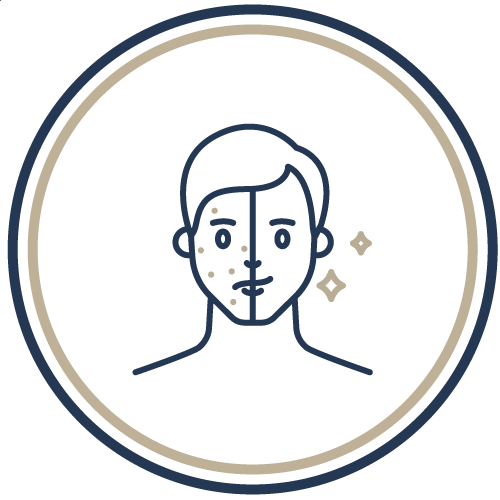 K.O. 不同 類型暗瘡*